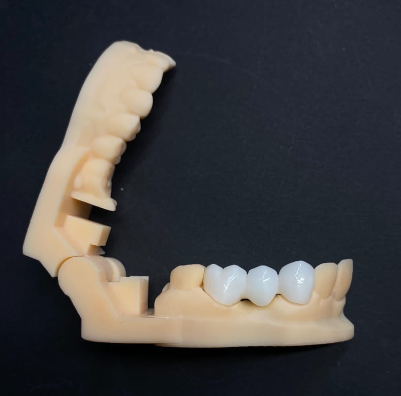 Goaligner